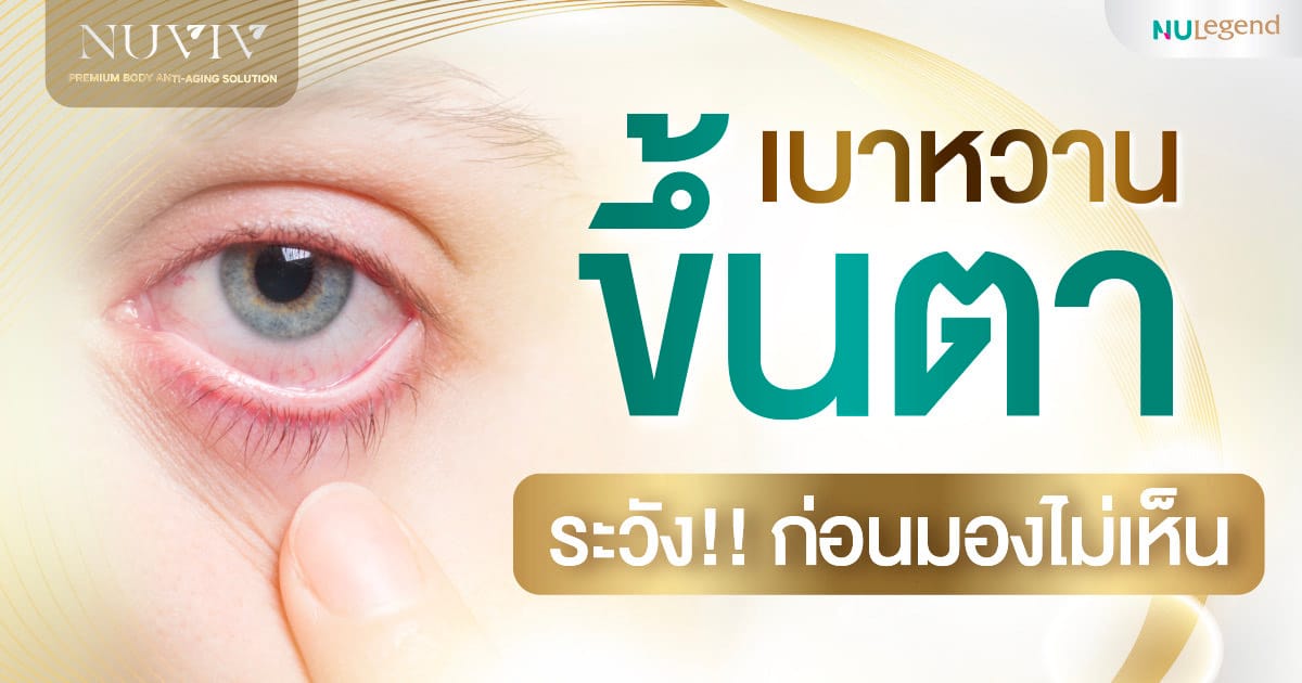 เบาหวานขึ้นตา เป็นภาวะแทรกซ้อน